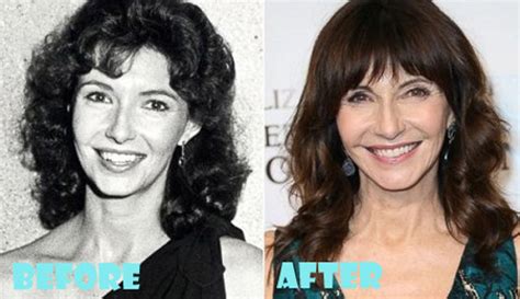 mary steenburgen boobs|Mary Steenburgen Plastic Surgery Before and After